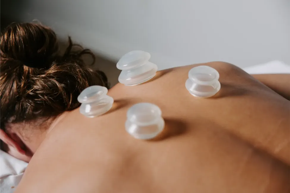 Cupping session
