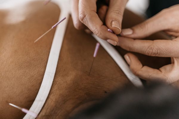 Tampa acupuncturist science behind acupuncture