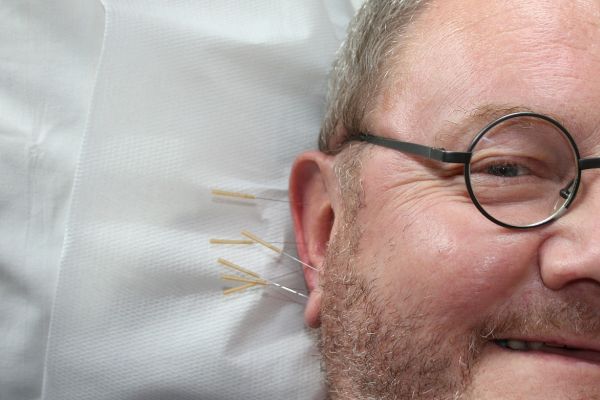 Acupuncture Needles Ear Pain Relief Driven Fit Sponaugle Wellness Tampa FL