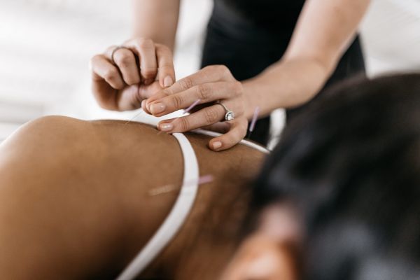 Acupuncture and allergies Driven + SWS Tampa Acupuncture