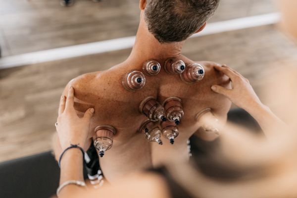 Cupping Therapy in Tampa FL Driven SWS